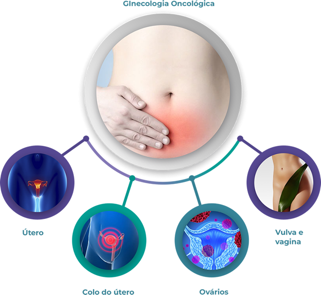 Imagem - Ginecologia Oncológica
